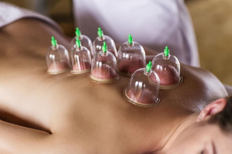 Cupping massage 