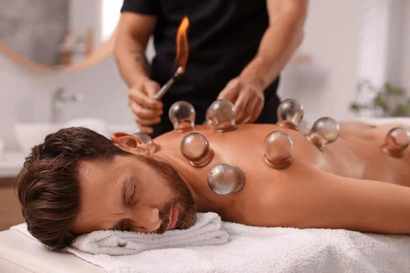 cupping therapy