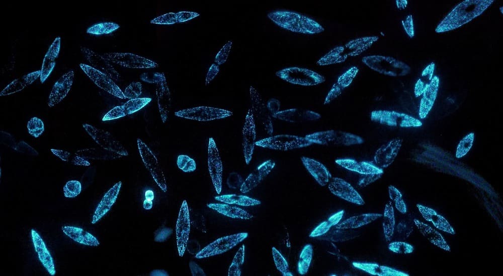 plankton under a microscope